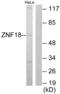 Zinc Finger Protein 18 antibody, abx013402, Abbexa, Western Blot image 