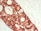 Protein S100-A6 antibody, LS-C744588, Lifespan Biosciences, Immunohistochemistry paraffin image 