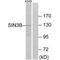 Paired amphipathic helix protein Sin3b antibody, A06424, Boster Biological Technology, Western Blot image 