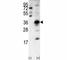 Snail Family Transcriptional Repressor 1 antibody, F47915-0.4ML, NSJ Bioreagents, Western Blot image 