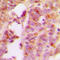 Insulin Receptor Substrate 1 antibody, LS-C356136, Lifespan Biosciences, Immunohistochemistry paraffin image 