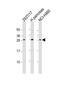 Catechol-O-Methyltransferase Domain Containing 1 antibody, 62-444, ProSci, Western Blot image 