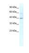 Potassium Channel Tetramerization Domain Containing 10 antibody, NBP1-80086, Novus Biologicals, Western Blot image 