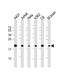 Ribosomal Protein S10 antibody, M06898, Boster Biological Technology, Western Blot image 