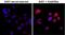 Phosphothreonine antibody, NBP2-77398, Novus Biologicals, Immunofluorescence image 