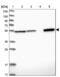 Aldehyde Dehydrogenase 7 Family Member A1 antibody, NBP1-88908, Novus Biologicals, Western Blot image 