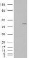 Beta-1,3-galactosyl-O-glycosyl-glycoprotein beta-1,6-N-acetylglucosaminyltransferase 3 antibody, GTX88863, GeneTex, Western Blot image 