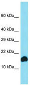 Cytochrome B561 Family Member D1 antibody, TA335350, Origene, Western Blot image 