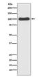 Cell Division Cycle 5 Like antibody, M03797, Boster Biological Technology, Western Blot image 