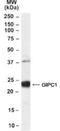GIPC PDZ Domain Containing Family Member 1 antibody, NB100-1353, Novus Biologicals, Western Blot image 