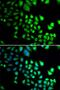 RB Binding Protein 5, Histone Lysine Methyltransferase Complex Subunit antibody, PA5-77082, Invitrogen Antibodies, Immunofluorescence image 