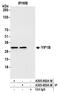 Yip1 Interacting Factor Homolog B, Membrane Trafficking Protein antibody, A305-802A-M, Bethyl Labs, Immunoprecipitation image 