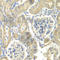 Ornithine Decarboxylase Antizyme 1 antibody, A7444, ABclonal Technology, Immunohistochemistry paraffin image 