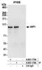 Huntingtin Interacting Protein 1 antibody, A305-176A, Bethyl Labs, Immunoprecipitation image 