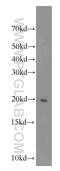 Spermatogenesis Associated 19 antibody, 16656-1-AP, Proteintech Group, Western Blot image 