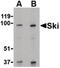 SKI Proto-Oncogene antibody, LS-B552, Lifespan Biosciences, Western Blot image 