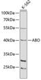 ABO, Alpha 1-3-N-Acetylgalactosaminyltransferase And Alpha 1-3-Galactosyltransferase antibody, GTX55487, GeneTex, Western Blot image 