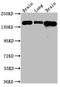 Fibroblast Growth Factor Receptor 2 antibody, CSB-RA154582A0HU, Cusabio, Western Blot image 