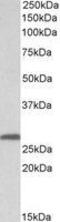 Stratifin antibody, GTX89431, GeneTex, Western Blot image 