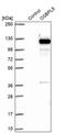 Oxysterol Binding Protein Like 5 antibody, PA5-58507, Invitrogen Antibodies, Western Blot image 