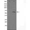 POTE ankyrin domain family member B antibody, orb226868, Biorbyt, Western Blot image 