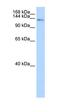 CDKN1A Interacting Zinc Finger Protein 1 antibody, orb330030, Biorbyt, Western Blot image 