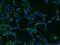 Stromal Interaction Molecule 1 antibody, 66189-1-Ig, Proteintech Group, Immunofluorescence image 