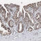 Activator Of Transcription And Developmental Regulator AUTS2 antibody, HPA000390, Atlas Antibodies, Immunohistochemistry paraffin image 
