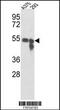 Tyrosinase antibody, MBS9210480, MyBioSource, Western Blot image 