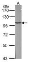Adaptor Related Protein Complex 2 Subunit Beta 1 antibody, LS-C185428, Lifespan Biosciences, Western Blot image 