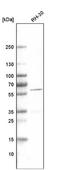 Desmin antibody, NBP2-59055, Novus Biologicals, Western Blot image 
