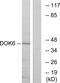 Docking Protein 6 antibody, GTX87172, GeneTex, Western Blot image 