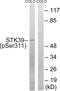 Serine/Threonine Kinase 39 antibody, 79-866, ProSci, Western Blot image 