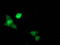 Signal Transducer And Activator Of Transcription 5A antibody, LS-C172876, Lifespan Biosciences, Immunofluorescence image 