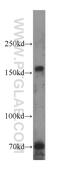 RAC3 antibody, 22707-1-AP, Proteintech Group, Western Blot image 