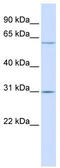 Transmembrane Protein 106C antibody, TA338645, Origene, Western Blot image 