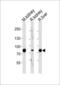 Enoyl-CoA Hydratase And 3-Hydroxyacyl CoA Dehydrogenase antibody, GTX81126, GeneTex, Western Blot image 