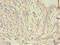 Junction Plakoglobin antibody, CSB-PA12839A0Rb, Cusabio, Immunohistochemistry paraffin image 