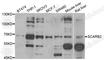 Scavenger Receptor Class B Member 2 antibody, A6285, ABclonal Technology, Western Blot image 