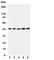Hepsin antibody, R31144, NSJ Bioreagents, Western Blot image 