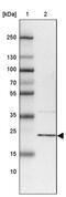 RWD Domain Containing 1 antibody, PA5-55958, Invitrogen Antibodies, Western Blot image 