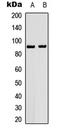 Heat Shock Protein 90 Alpha Family Class B Member 1 antibody, LS-C359019, Lifespan Biosciences, Western Blot image 