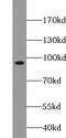 Zinc Finger CCCH-Type Containing 11A antibody, FNab09600, FineTest, Western Blot image 