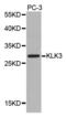 Kallikrein Related Peptidase 3 antibody, abx001669, Abbexa, Western Blot image 