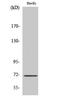 Neurofibromin 2 antibody, STJ94445, St John