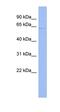 UPF3A Regulator Of Nonsense Mediated MRNA Decay antibody, orb324921, Biorbyt, Western Blot image 