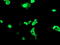 Myocyte Enhancer Factor 2C antibody, TA502715, Origene, Immunofluorescence image 