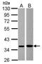 Mitogen-Activated Protein Kinase Kinase 6 antibody, PA5-28327, Invitrogen Antibodies, Western Blot image 