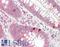 Phosphoinositide-3-Kinase Regulatory Subunit 1 antibody, LS-B12887, Lifespan Biosciences, Immunohistochemistry paraffin image 
