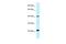 Coiled-Coil Domain Containing 68 antibody, A16220, Boster Biological Technology, Western Blot image 